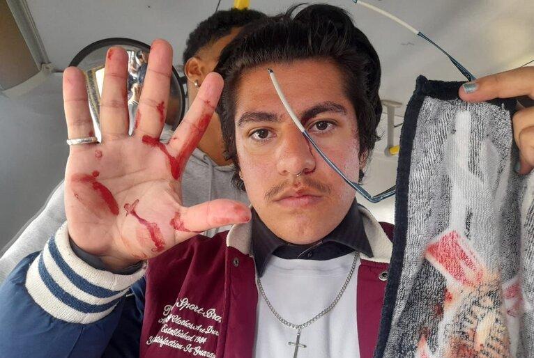 Estudante agredido mostra mão suja de sangue.