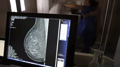 Câncer de mama: 1 em cada 3 diagnósticos ocorre em mulheres com menos de 50 anos