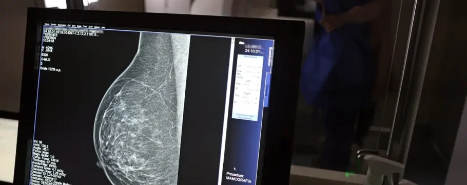 Câncer de mama: 1 em cada 3 diagnósticos ocorre em mulheres com menos de 50 anos