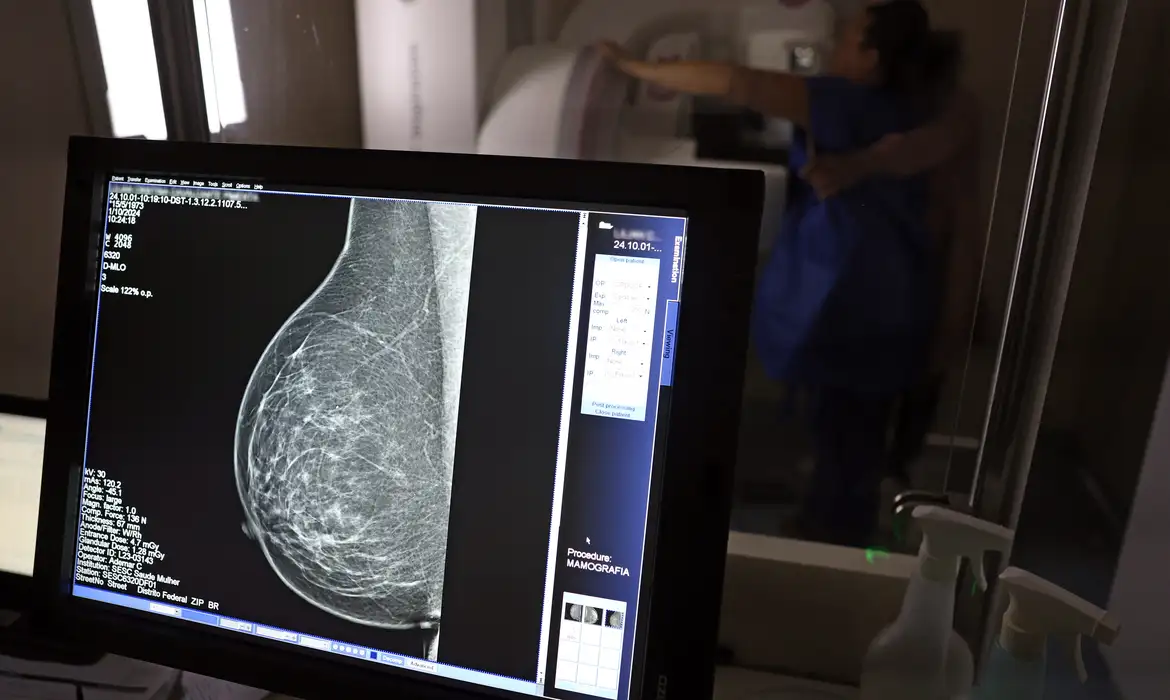 Câncer de mama: 1 em cada 3 diagnósticos ocorre em mulheres com menos de 50 anos