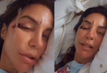 Ivete Sangalo é hospitalizada após queda e tranquiliza fãs nas redes sociais