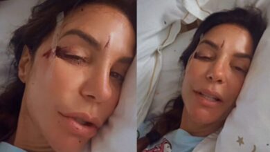 Ivete Sangalo é hospitalizada após queda e tranquiliza fãs nas redes sociais